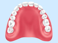 総入れ歯