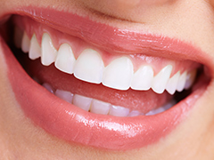 良い歯並びは虫歯や歯周病の予防につながります